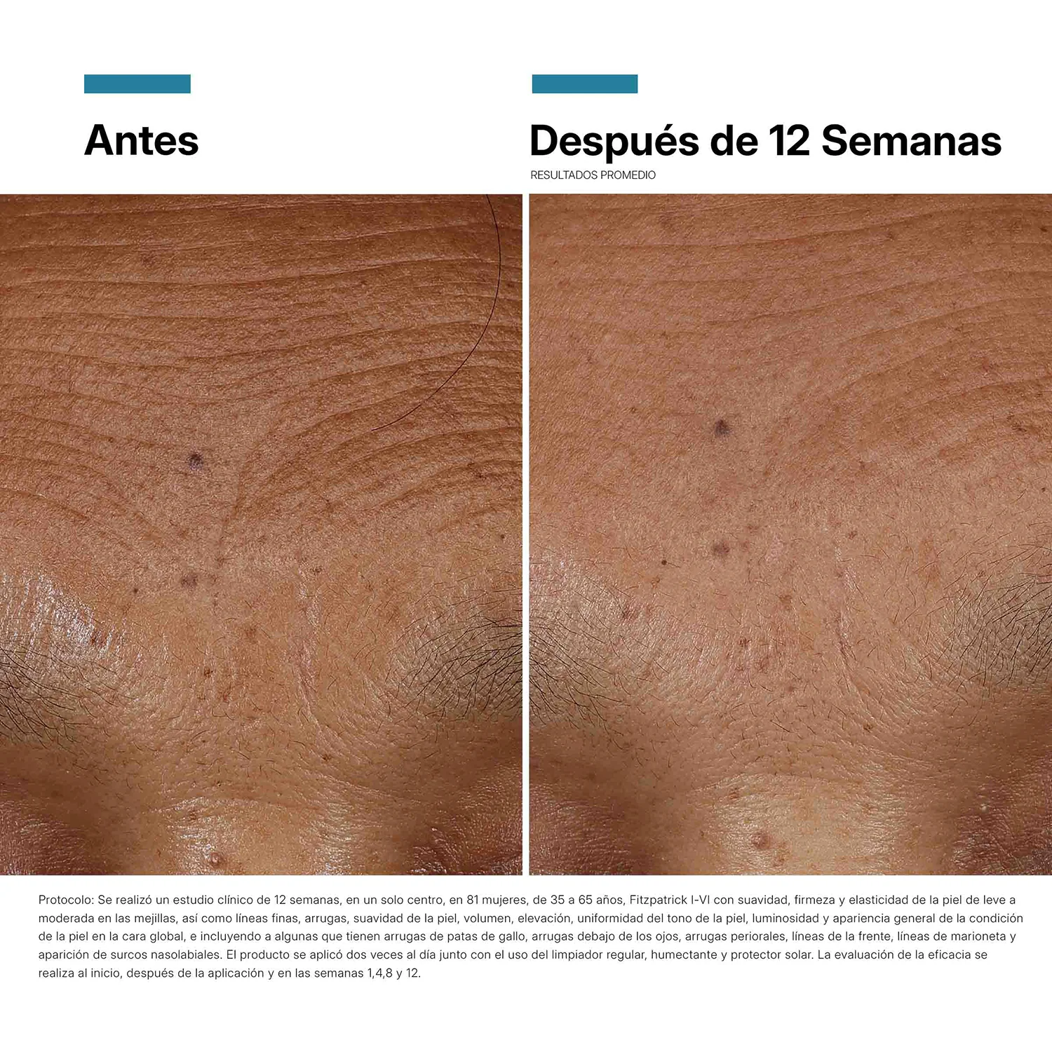 Imagen del producto 11